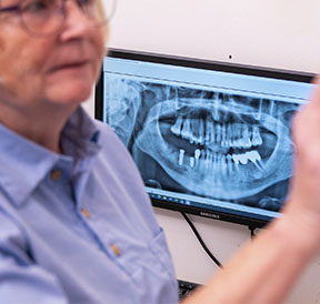 røntgen af tænder